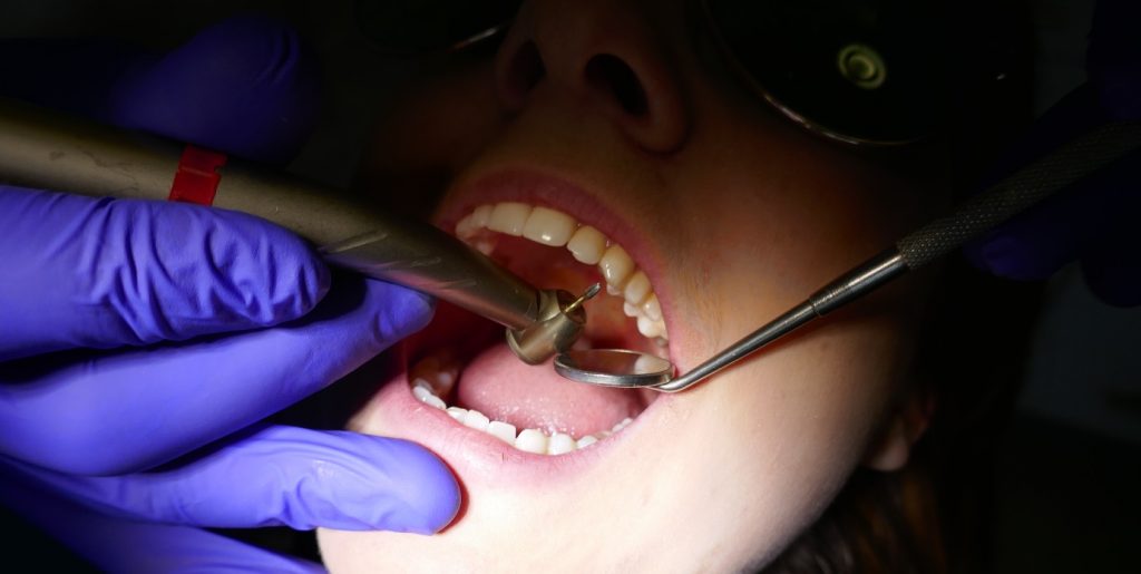 numbing gel for teeth cleaning