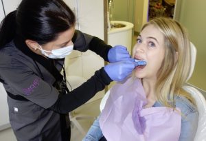 dental staff taking impression for whitening trays
