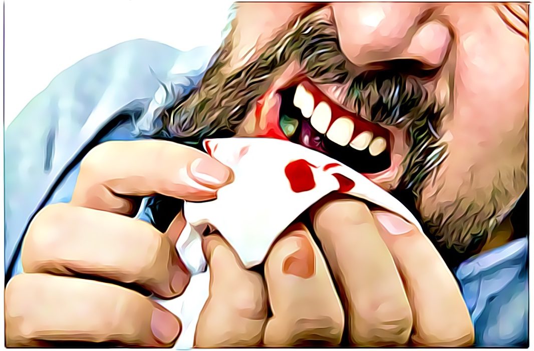 bleeding gums after eating