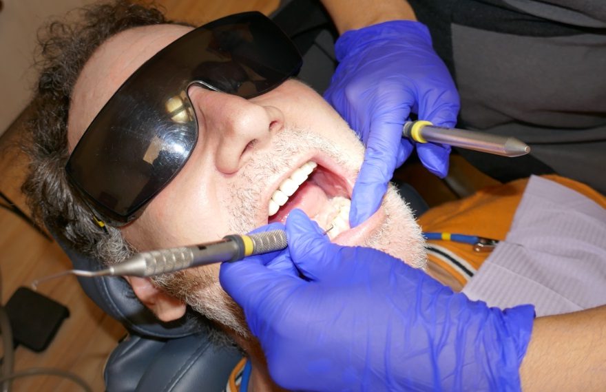teeth cleaning in Toronto at Archer Dental Little Italy