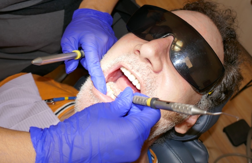 teeth cleaning in Toronto at Archer Dental Little Italy 