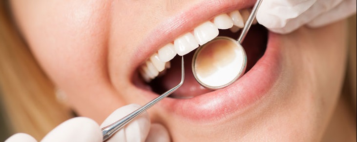 hygienists use small mirror dental issues oral health