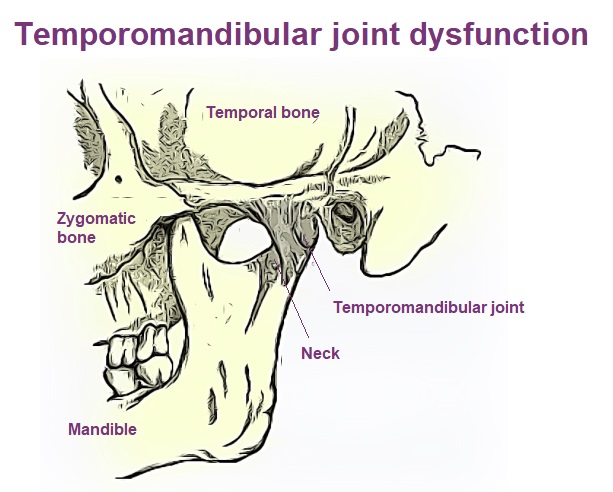 Temporomandibular joint (TMJ) graphic showing muscles and bones in skull.