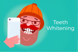Whitening for an Instagram-worthy smile!