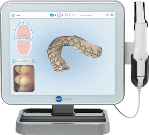itero 3D dental scanners, oral scanner