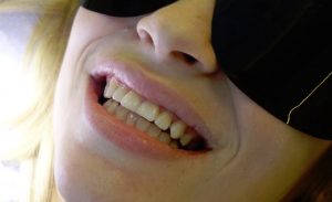 Cynthia Menard, close on smile AFTER teeth whotening