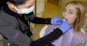 dental impressions for teeth whitening trays