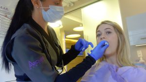 getting dental impressions - top teeth - alginate tray impressions