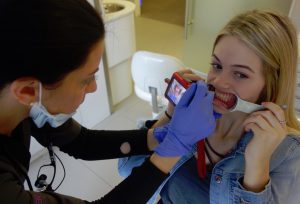 Pictures of teeth before the cleaning and whitening with digital camera