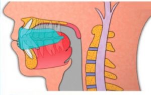 Myobrace system for treating crooked teeth at the root origins TMJ misaligned jaws children myofunctional behaviour