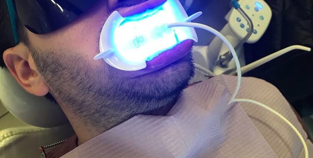 GLO Science teeth whitennig in Toronto