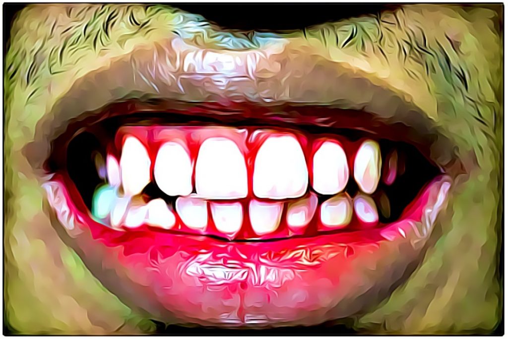 bleeding gums after brushing