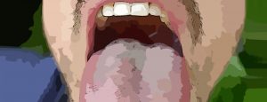 infected mouth