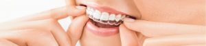 Get Invisalign in Toronto