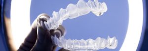 Invisalign, Smart track