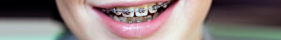 Orthodontic services in Toronto