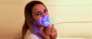 Teeth whitening