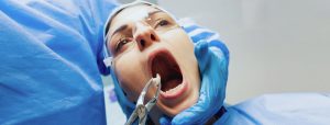 Wisdom Teeth Removal in Toronto