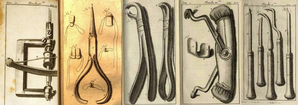 1800's era dental tools depicted in Pierre Fauchand's Le Chirurgien Dentiste  