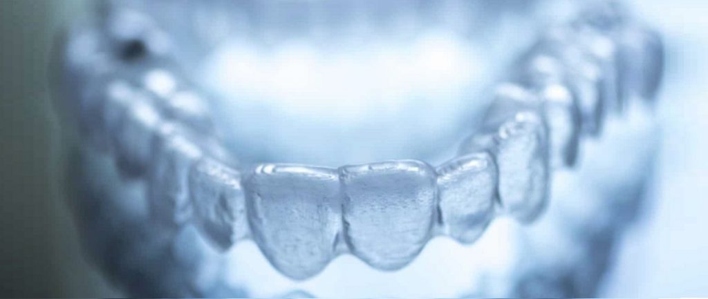 Invisalign plastic aligner