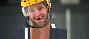 Dental implants, restorative dentistry in Toronto