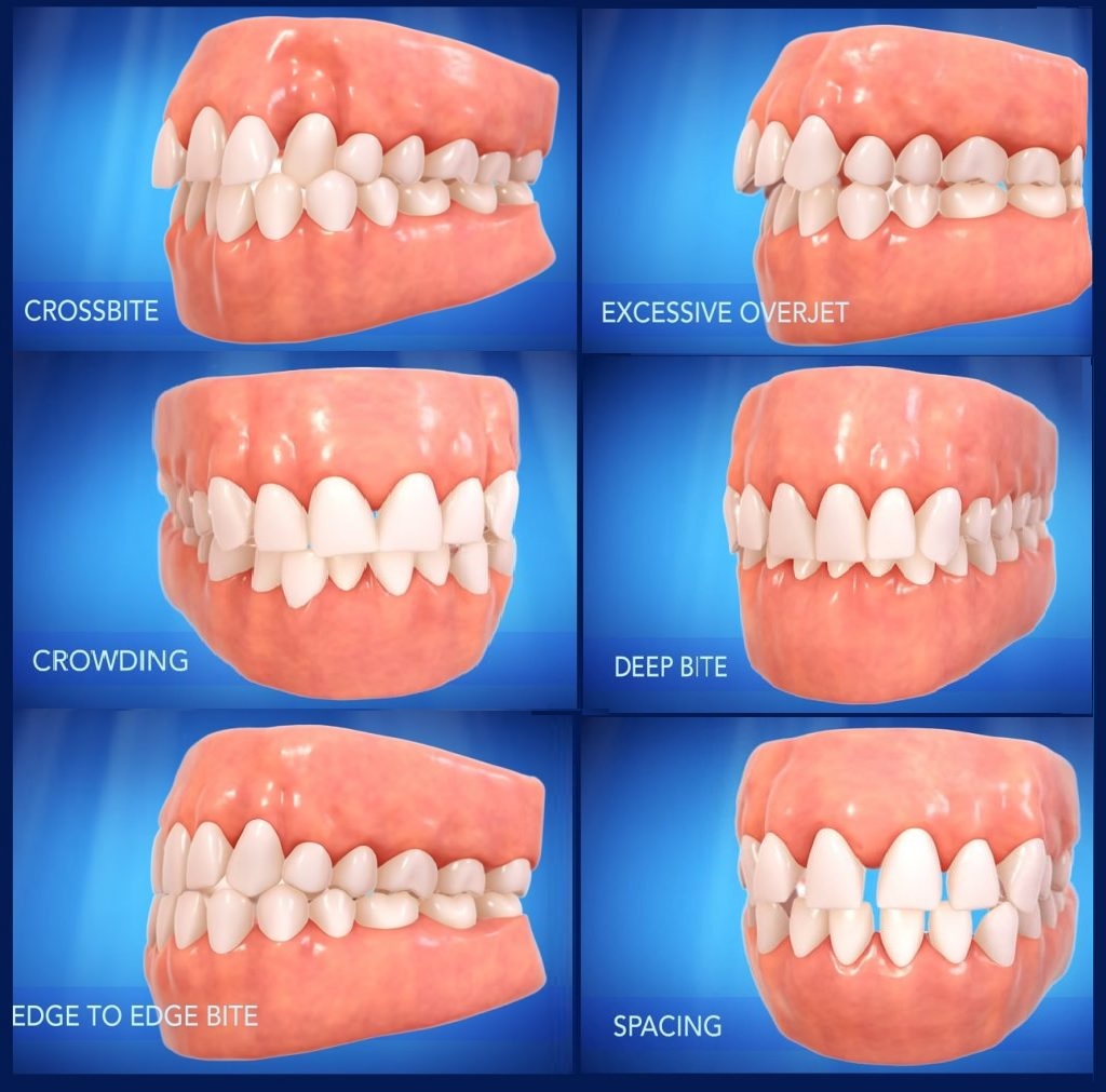 common orthodontic treatments at Archer Dental