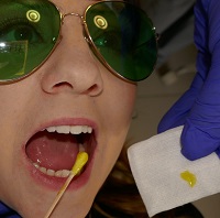 Topical anesthesia used to numb teeth and gums before surgery.